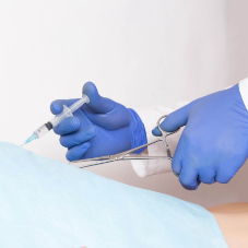 Лигирование