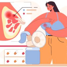 Гнойный мастит