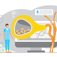 Острый холецистит
