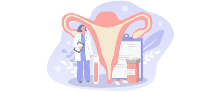 Удаление кисты яичников