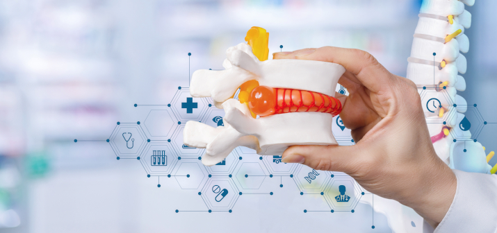 Грыжа поясничного отдела позвоночника