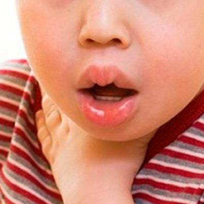 Крапивница и отек Квинке