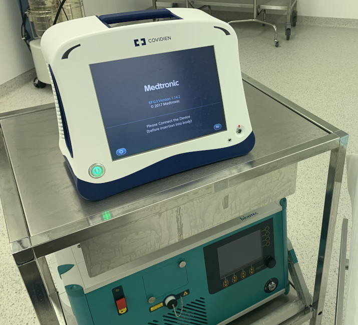 Радиочастотная облитерация (абляция) варикозных вен