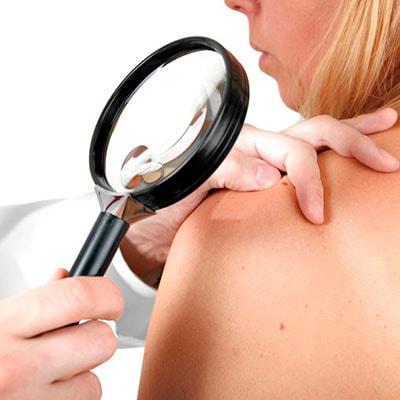 Бесплатный прием дерматолога