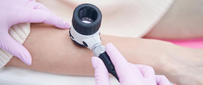 Дерматоскопия