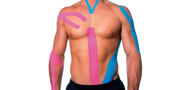 Кинезиотейпирование при болях в спине