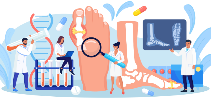 Артроз плюснефалангового сустава