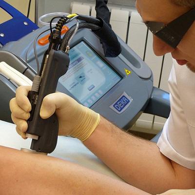 Как лечить варикоз: консервативное и оперативное лечение