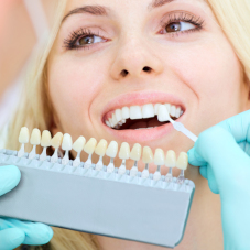 Всё, что нужно знать о винирах 