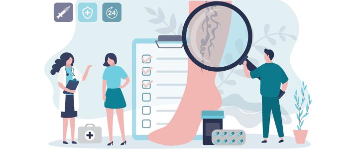 Лечение варикоза