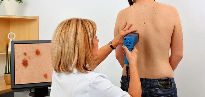 День диагностики меланомы