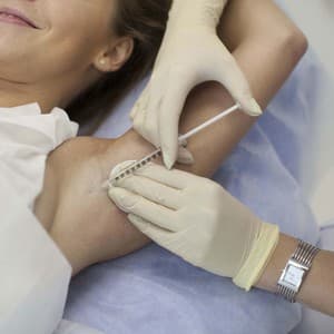 Лечение гипергидроза (повышенной потливости)