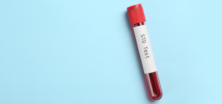 Первичный сифилис