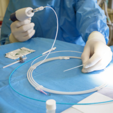 Клеевая облитерация варикозных вен методом Venaseal