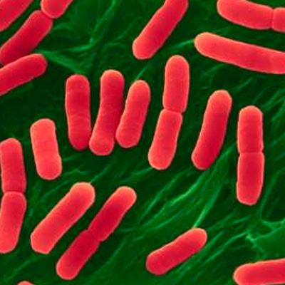 Кишечная инфекция: 6 способов уберечься от невидимого врага