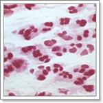 колликулит