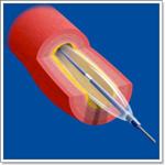 Причины развития инфаркта миокарда