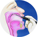 Эндоскопическая аденотомия