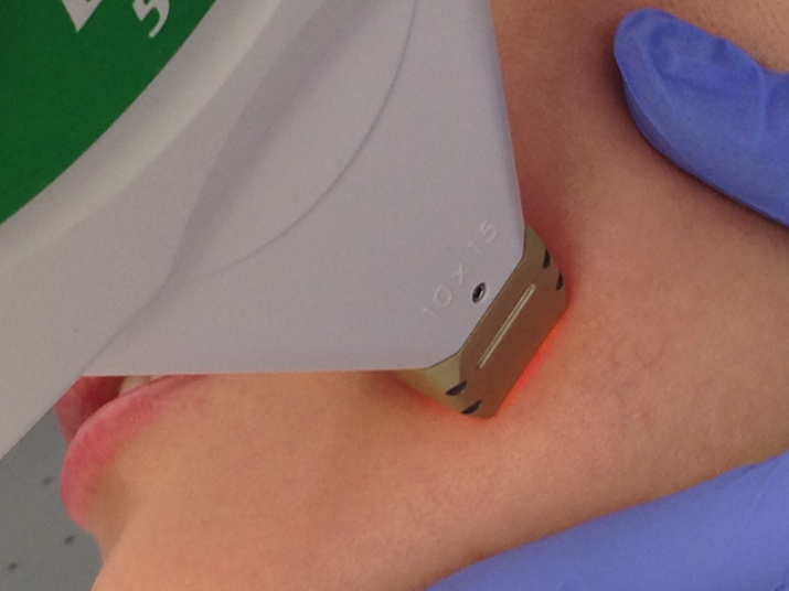 Фототерапия