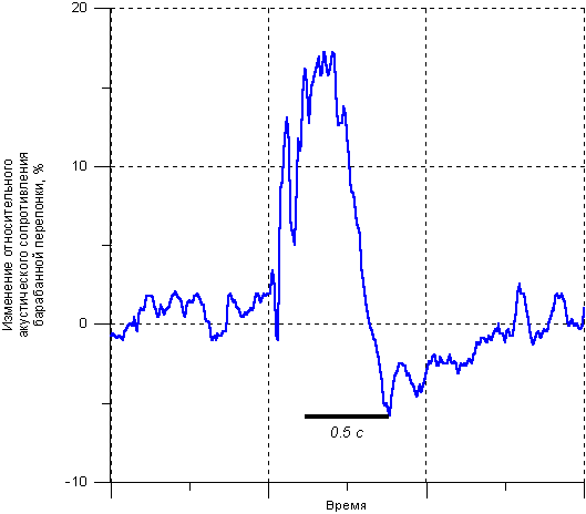 Лаборатория вестибулярных расстройств
