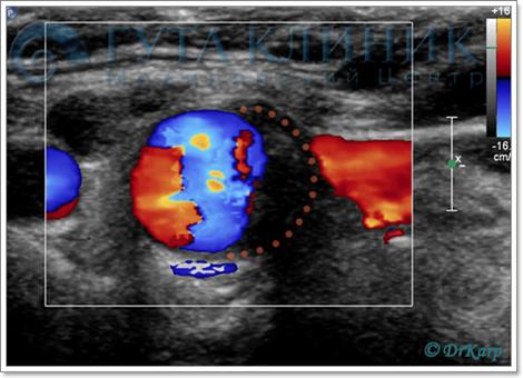 дуплексное сканирование