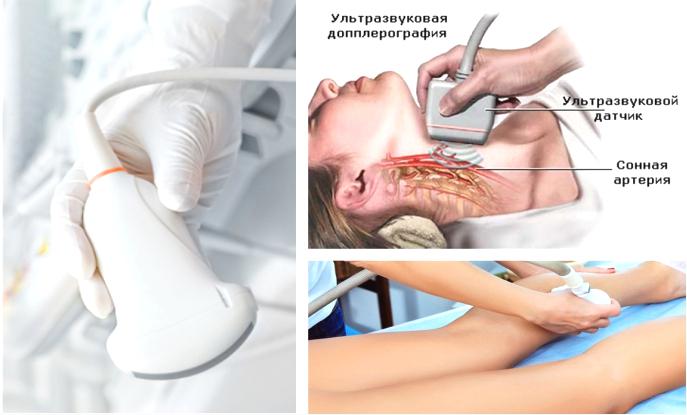 Дуплексное сканирование