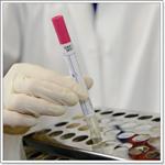 Диагностика вирусных инфекций 