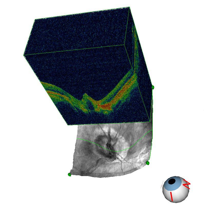 К статье ОКТ.jpg
