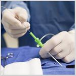 Лечение пельвиоперитонита