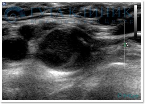 Дуплексное сканирование