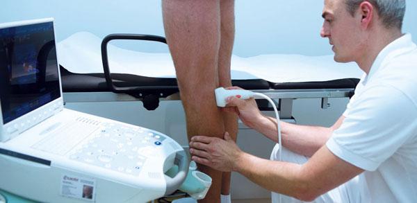 УЗИ вен