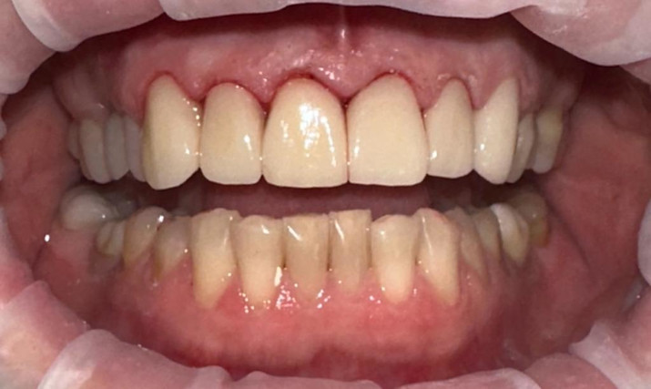 В момент фиксации