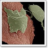 trichomonas vaginalis