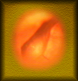 Лаборатория вестибулярных расстройств