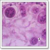 гистологическое исследование микоплазмоза