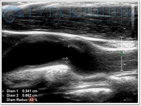 дуплексное сканирование