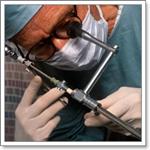 лапароскопия яичников