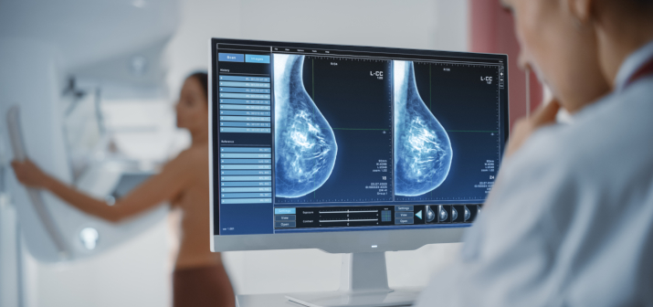 Маммография