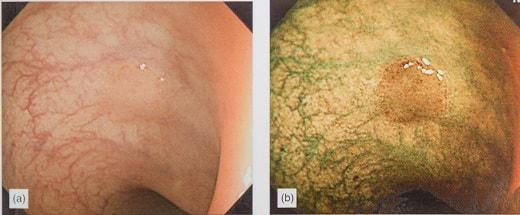 Изображение, полученное Olympus Exera III