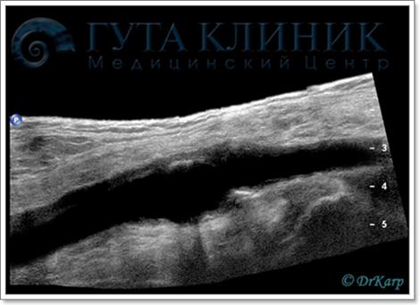 дуплексное сканирование