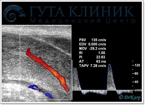 дуплексное сканирование