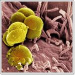 воспалительные заболевания